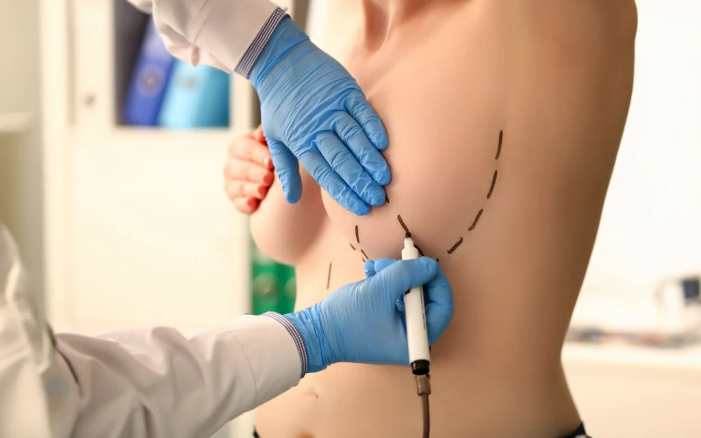 Breasts Recontouring regenerative aesthetics and dermatology laguna hills ca