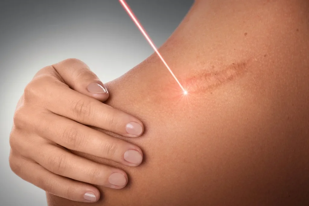 Hypertrophic-regenerative-aesthetics-and-dermatology-laguna-hills-ca