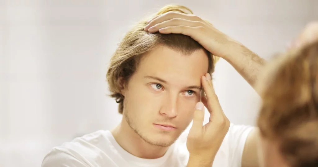 NouvaDerm Hair Restoration System by Regenerative Aesthetics and Dermatology