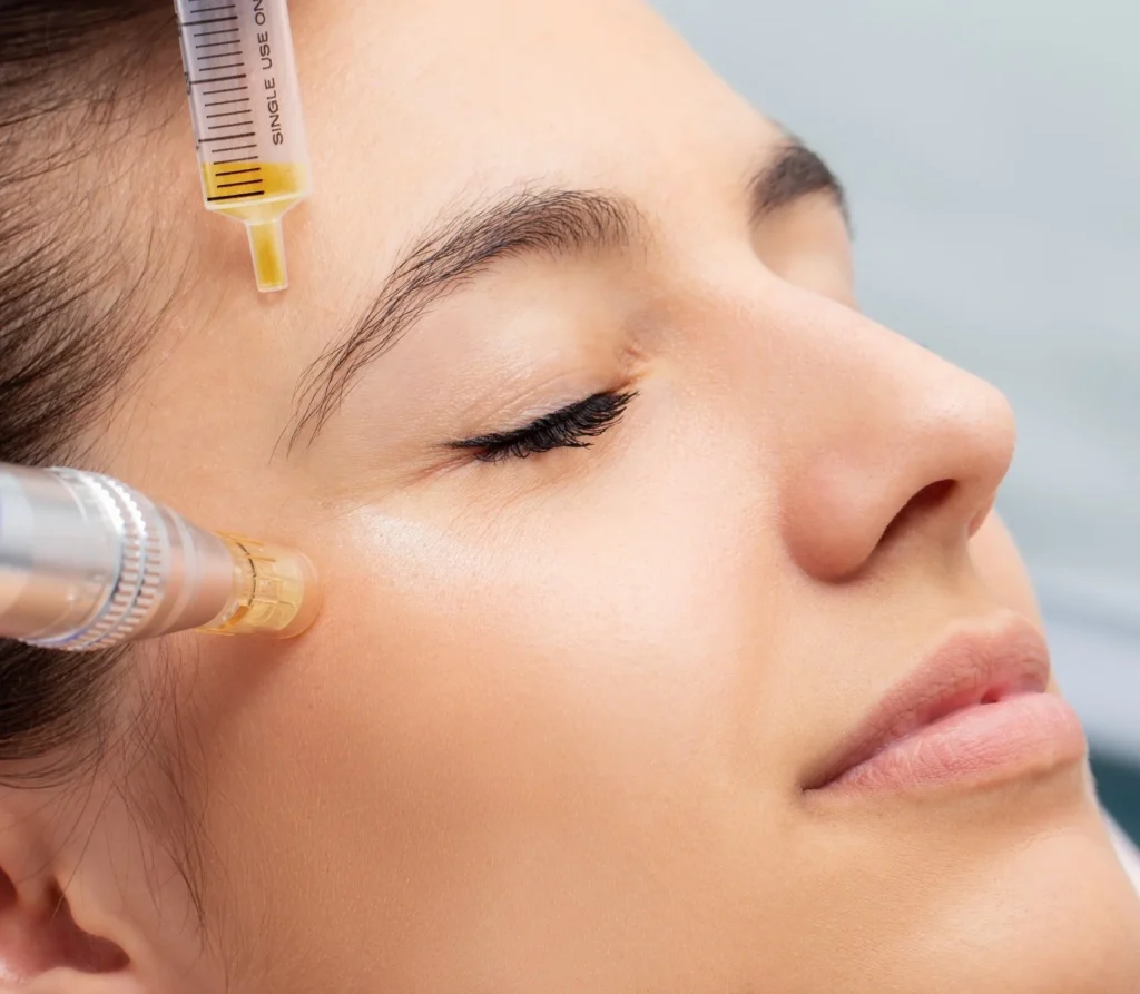PRP-and-Derma-regenerative-aesthetics-and-dermatology-laguna-hills-ca