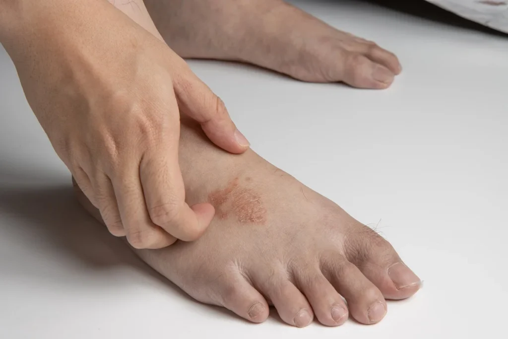 SKIN INFECTIONS rad laguna hills ca
