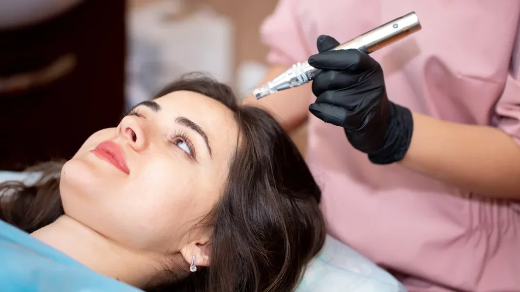 Scalp-Microneedling-regenerative-aesthetics-and-dermatology-laguna-hills-ca