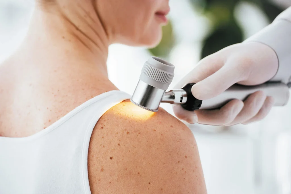Skin-Cancer-Screening-prevention-regenerative-aesthetics-and-dermatology-laguna-hills-ca