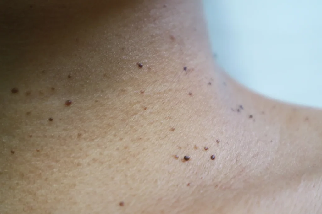 bengin regenerative aesthetics and dermatology rad laguna hills ca
