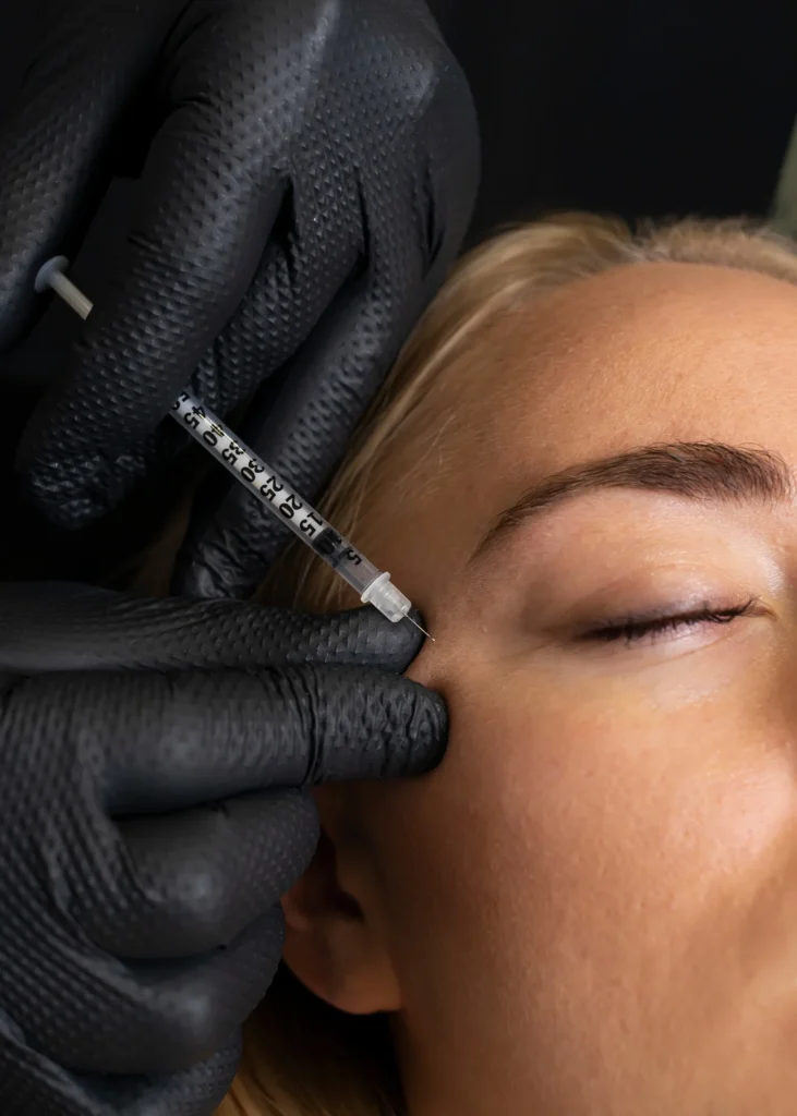 dyspot xeomin regenerative aesthetics and dermatology rad laguna hills ca