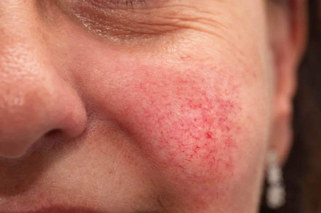eocesa regenerative aesthetics and dermatology rad laguna hills ca