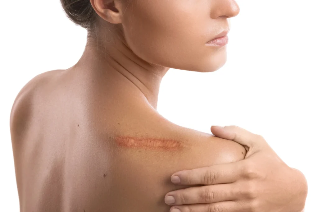 traumatic-and-surgical-regenerative-aesthetics-and-dermatology-rad-laguna-hills-ca