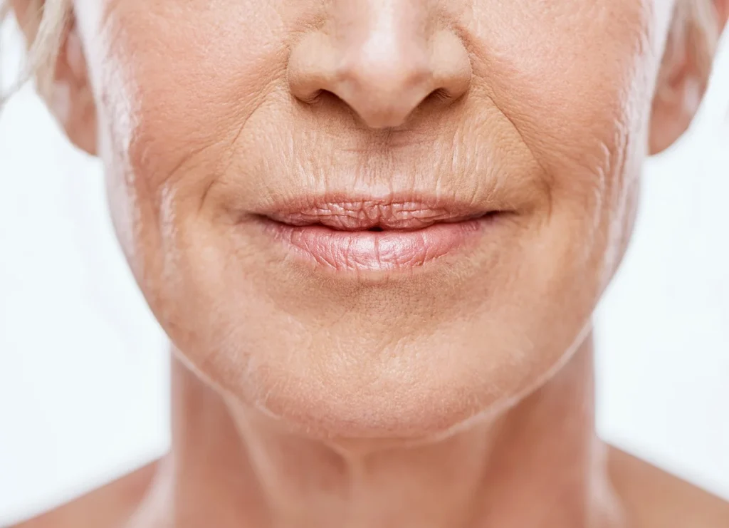 wrinkles regenerative aesthetics and dermatology rad laguna hills ca