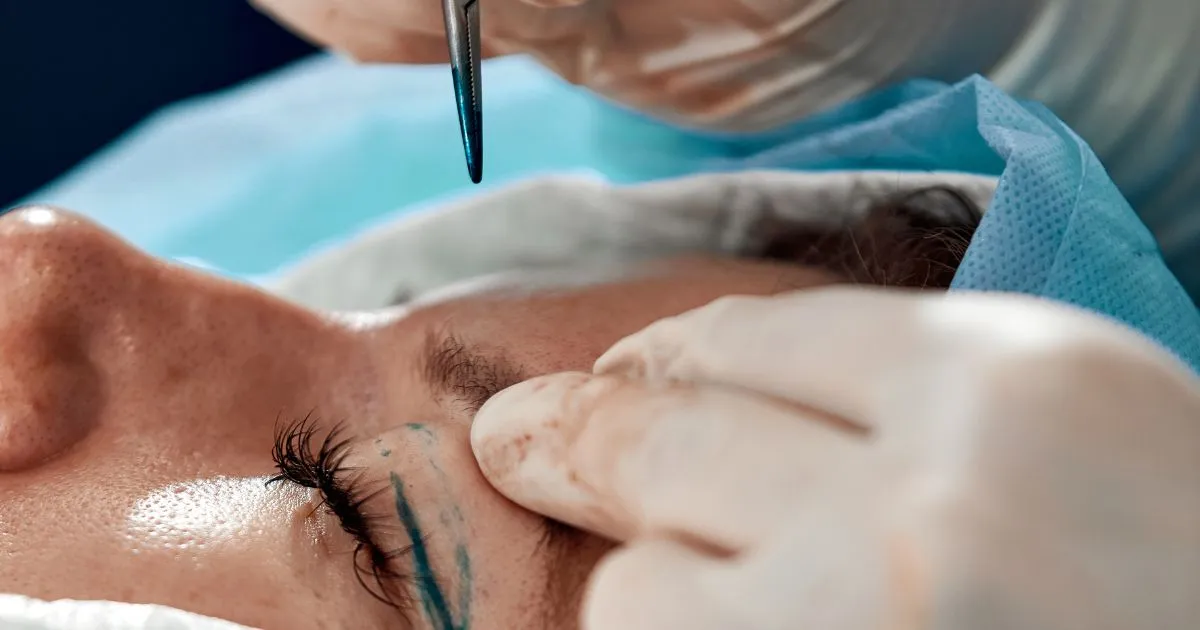 Blepharoplasty in Laguna Hills CA by Regenerative Aesthetics and Dermatology