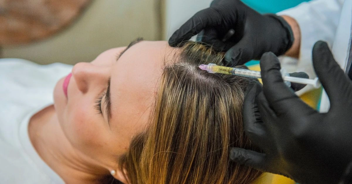 A close-up of a doctor injecting a woman's scalp with PRP for hair loss treatment.