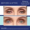 Upneeq Eye Drops - Image 2