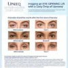Upneeq Eye Drops - Image 3